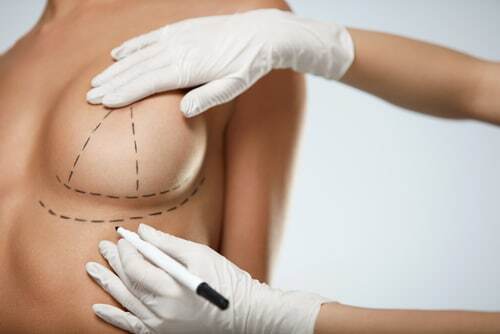 Breast Surgery in Buffalo, NY