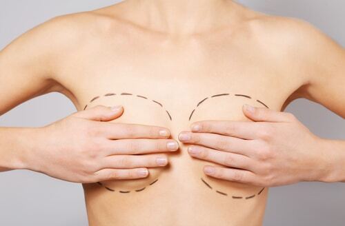 Breast Surgery in Buffalo, NY